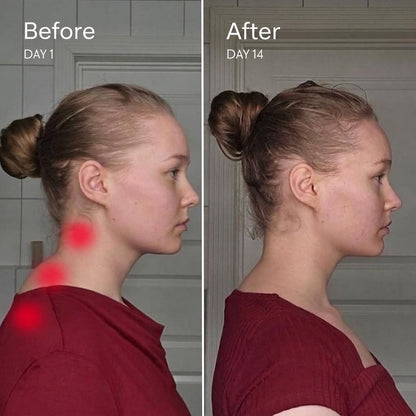 Side-by-side profile of a woman labeled before day 1 and after day 14